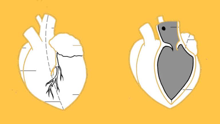 Heart dissection cross-section